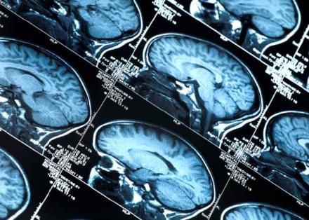 Parkinson's Awareness Day 2019